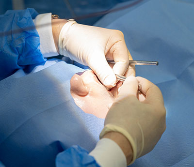 患者さんごとにグローブの交換